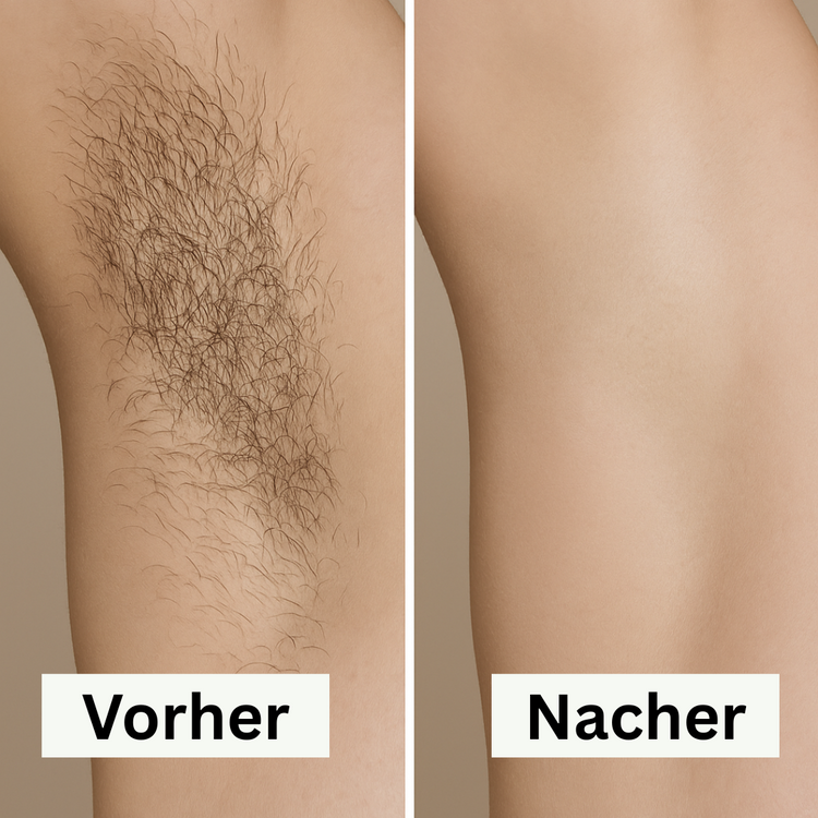 Haarreduktion nach 4 Wochen