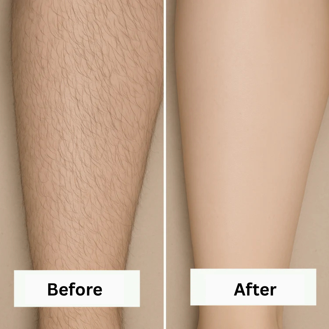 Removely: IPL 3+